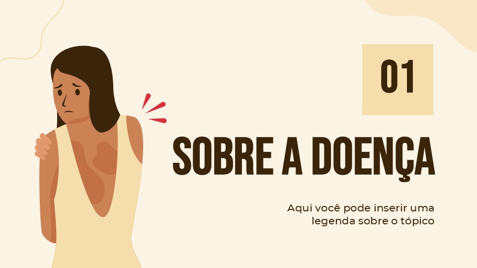 Free Burns Powerpoint Presentation Theme 4